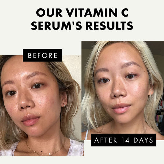 𝗢𝗥𝗚𝗔𝗡𝗜𝗖 20% Vitamin C Serum for Face WITH HYALURONIC ACID +RETINOL +FERULIC ACID +JOJOBA OIL +VIT E - Anti Aging Brightening Face Serum for Pure Skin Glow