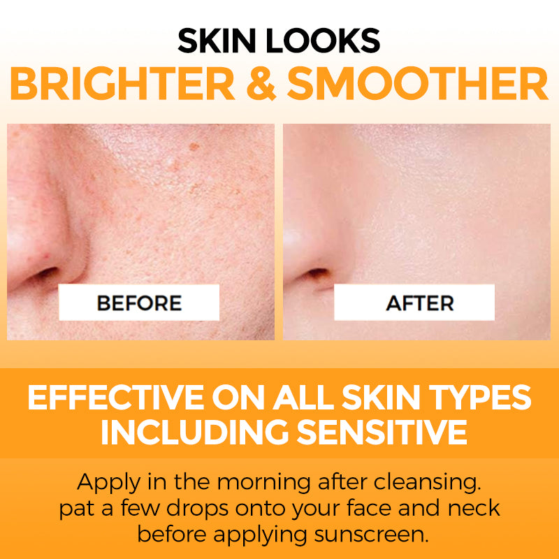 20% VITAMIN C Face Serum Brightening Face Serum Radiant Even Skin Tone