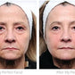 Facial Treatment Kit