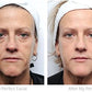 Facial Treatment Kit